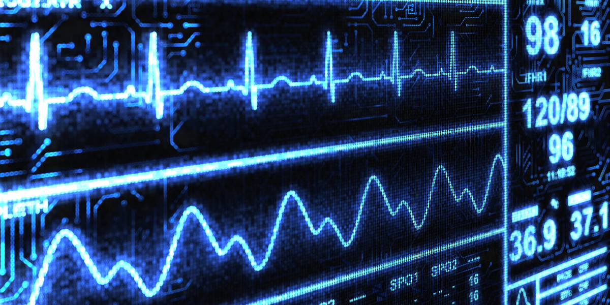 Cardiac Output Mastery - A Deeper Understanding