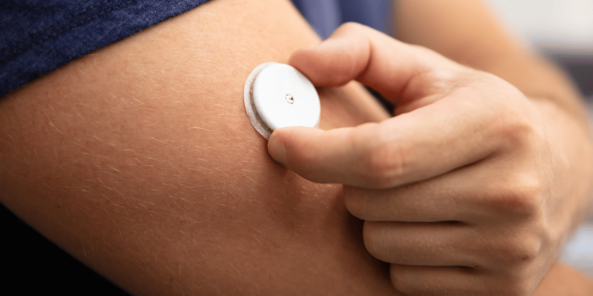 continuous glucose monitor